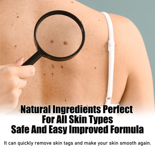 OUHOE Wart Treatment Patches