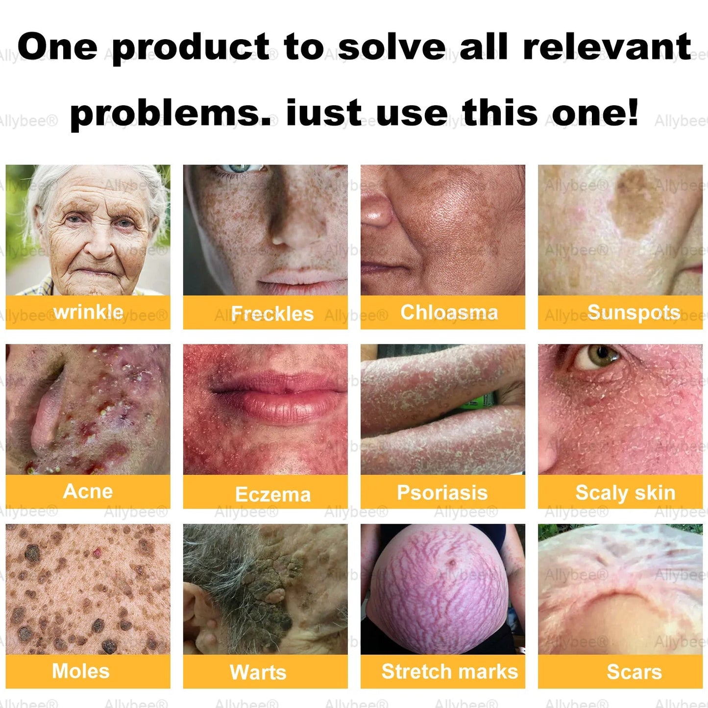 🔥Buy 3 Get 1 Free🔥HOUKEA Bee Venom Skin Treatment Cream
