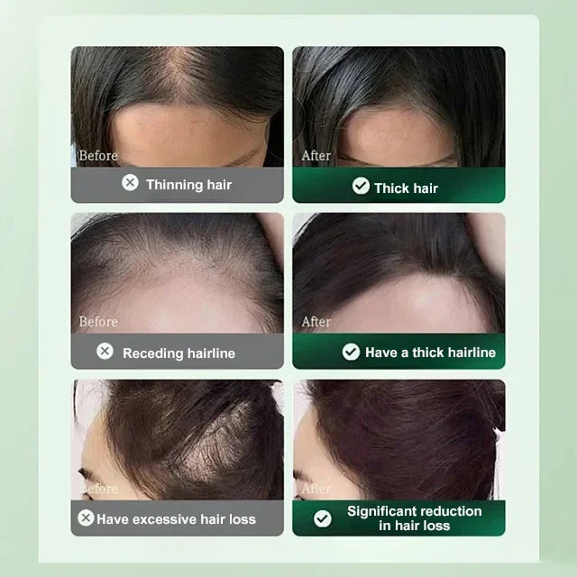 Anti-Hair Loss And Hair Growth Solution 🔥Buy 2 Get 1 Free🔥 (Free Shipping)