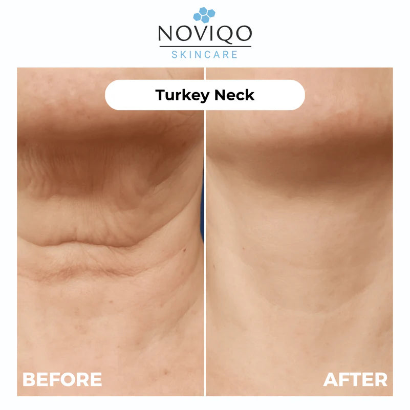 Anti-Wrinkle Nano-Silk Collagen Renewal System