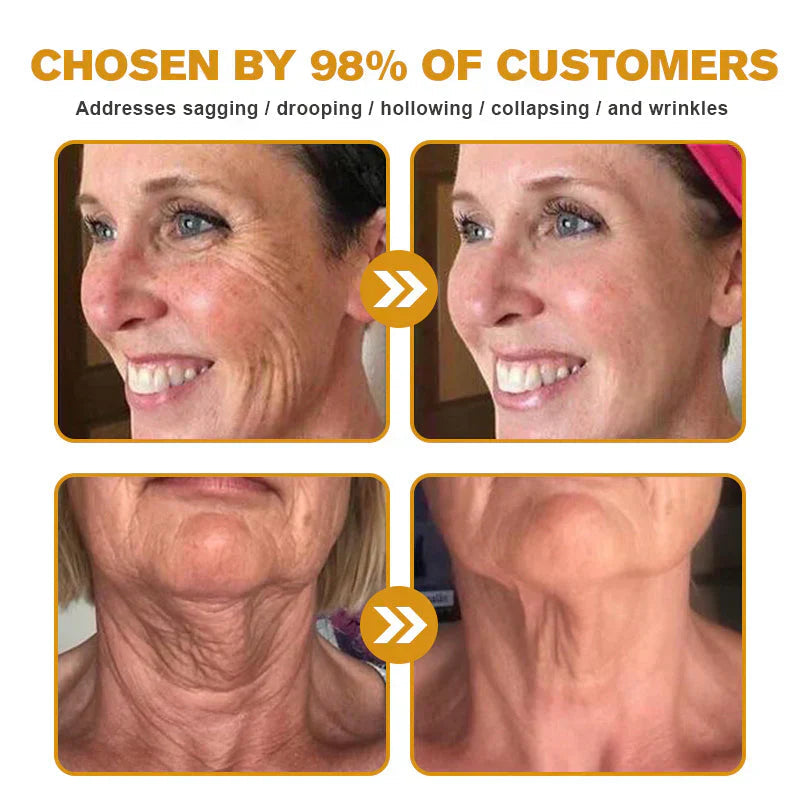 🔥Buy 3 Get 1 Free🔥HOUKEA Bee Venom Skin Treatment Cream
