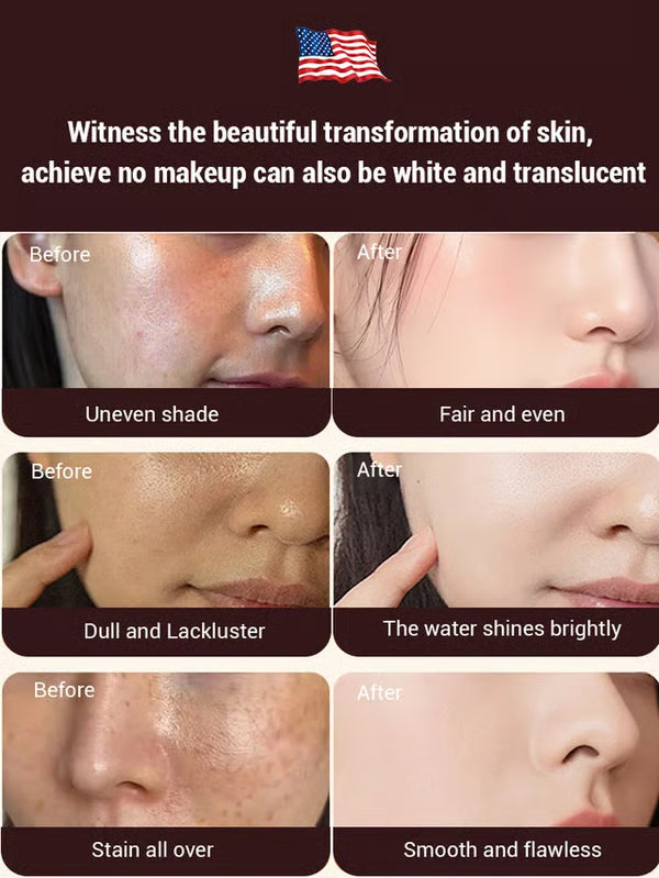 🔥Buy 1 Get 1 Free🔥7-Day Brightening and Whitening Ancient Formula Spot Removal Cream