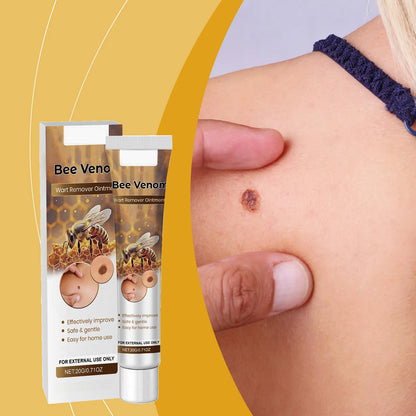 Pain-free Bee Venom Wart and Tags Removoal Cream