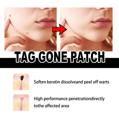 OUHOE Wart Treatment Patches