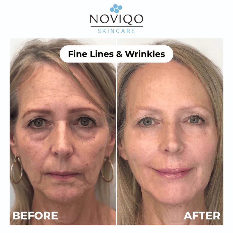 Anti-Wrinkle Nano-Silk Collagen Renewal System