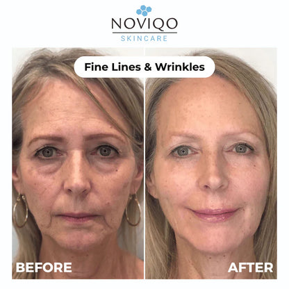 Anti-Wrinkle Nano-Silk Collagen Renewal System