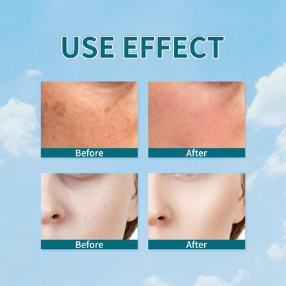 Facial Freckle Spot Serum