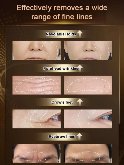 Boswellia Wrinkle Resistant Essence