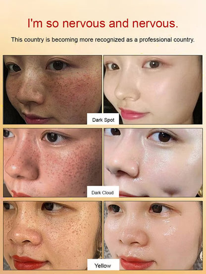 🔥BUY 1 GET 1 FREE🔥Whitening and anti-freckle essence