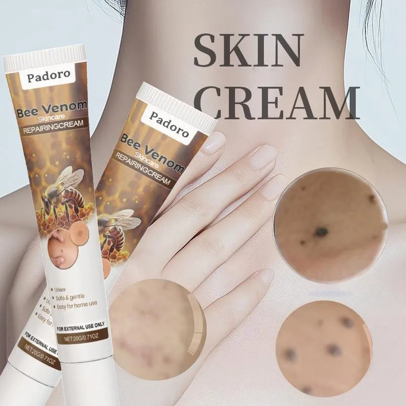 Pain-free Bee Venom Wart and Tags Removoal Cream