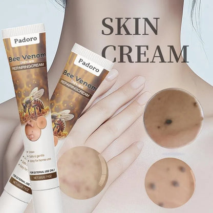 Pain-free Bee Venom Wart and Tags Removoal Cream
