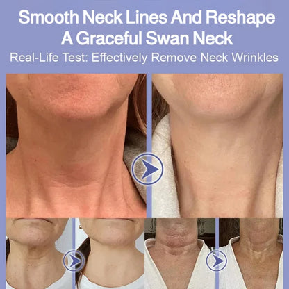 Moisturizing Neck Neck Care Cream Neck Cream Moisturizing and smooth antiwrinkle Lift and Firm brigh