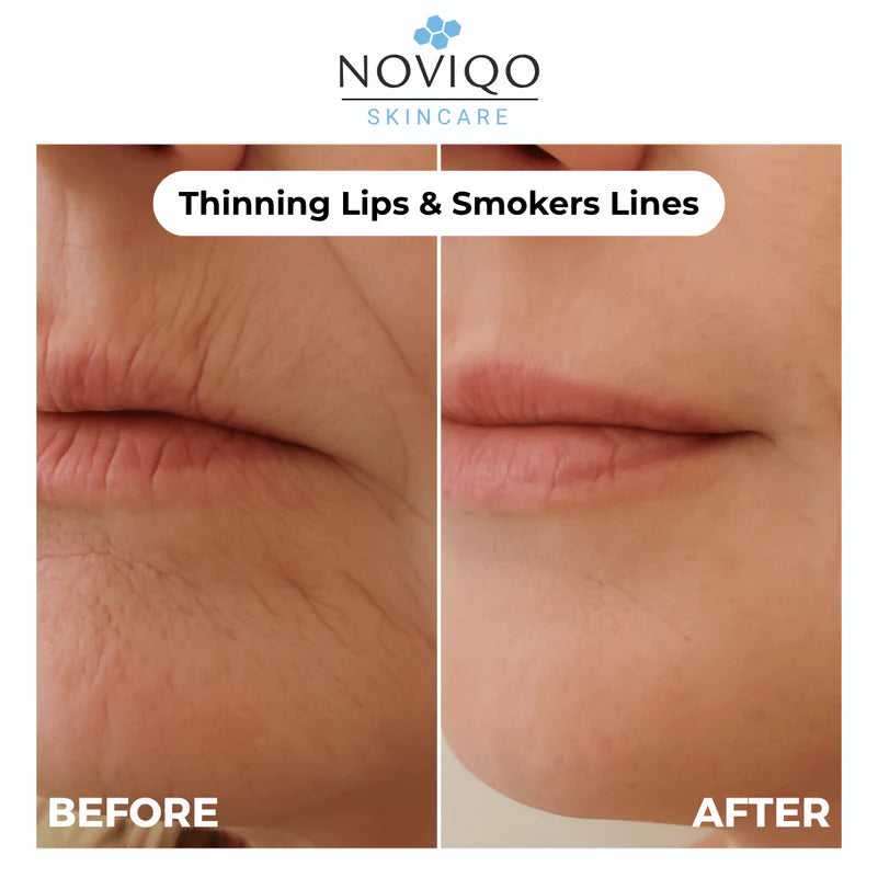 Anti-Wrinkle Nano-Silk Collagen Renewal System