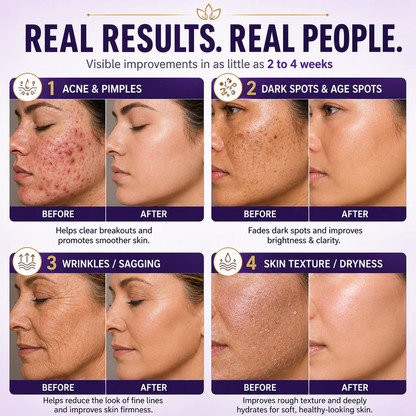 Limited-time offer: 70% off ⬇️Elivessa™ Biotin 10-in-1 Skin Restoration Cream