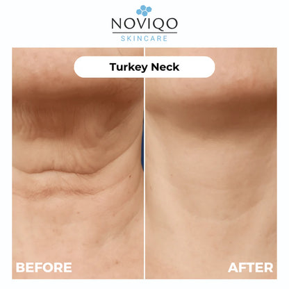 Anti-Wrinkle Nano-Silk Collagen Renewal System