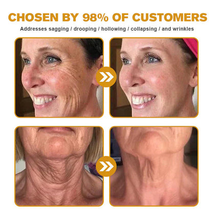 🔥Buy 3 Get 1 Free🔥HOUKEA Bee Venom Skin Treatment Cream