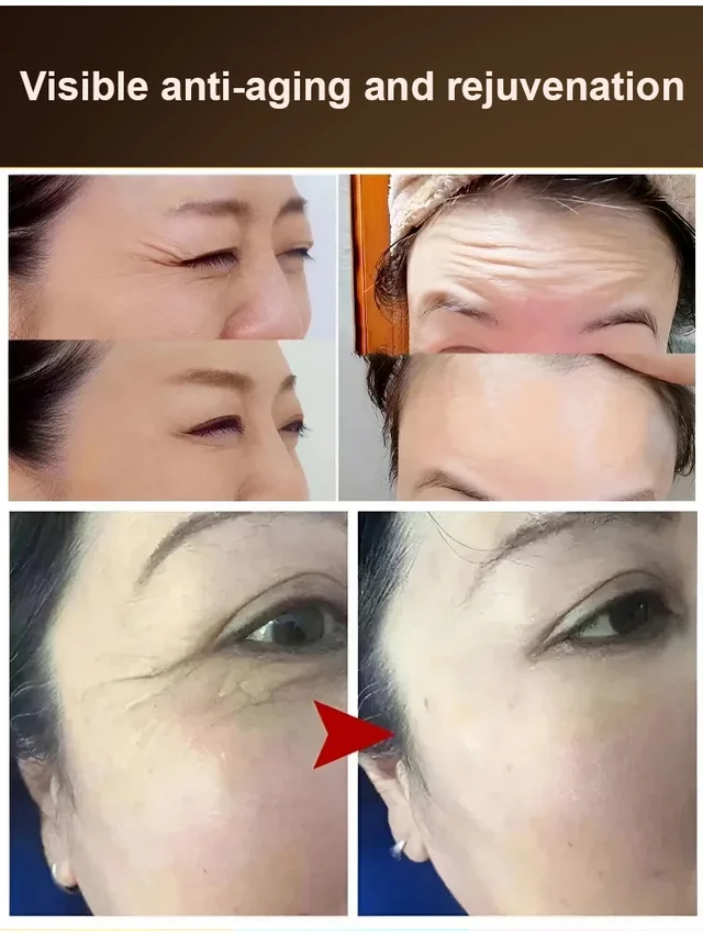 Boswellia Wrinkle Resistant Essence