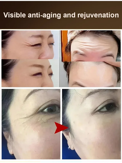 Boswellia Wrinkle Resistant Essence