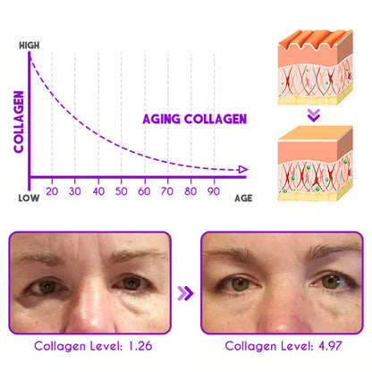 Pro-Xylane Active Eye Cream