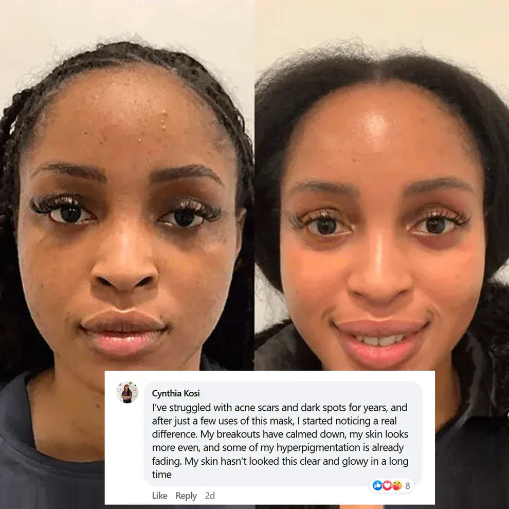 💧Pamper Yourself — Buy 2 Collagen Night Masks, Get 1 Free! Wake Up to Youthful, Hydrated Skin!