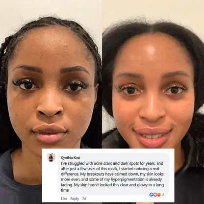 💧Pamper Yourself — Buy 2 Collagen Night Masks, Get 1 Free! Wake Up to Youthful, Hydrated Skin!