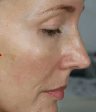 🔥【🎁2024 New Year Hot Sale🎁】5PAIRS INSTANT BEAUTY FACE NUTRITION WRINKLE REMOVAL LIFT STICKER