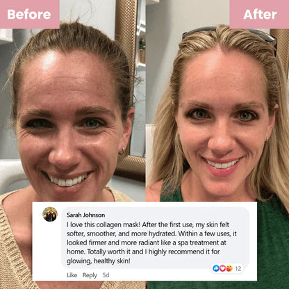 💧Pamper Yourself — Buy 2 Collagen Night Masks, Get 1 Free! Wake Up to Youthful, Hydrated Skin!