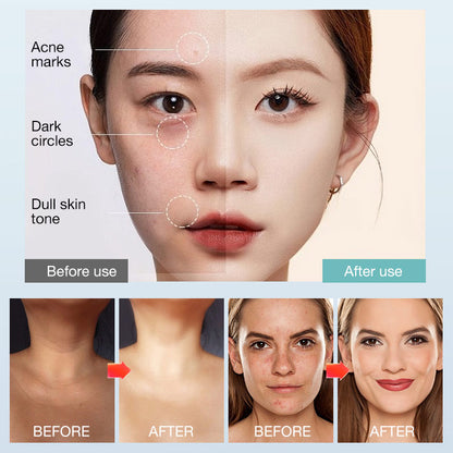 ALL-IN-ONE MOISTURIZER, CONCEALER & COVERAGE